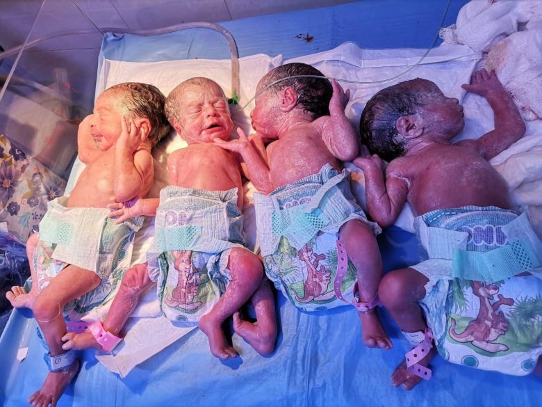 ولادة اربعة توائم لسيدة ثلاثينة في كربلاء